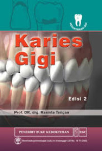 Image of Karies Gigi